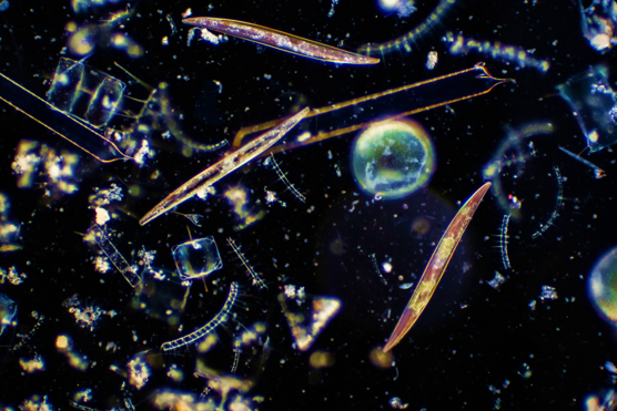 Focusing in on Aquatic Microbes: Berkeley Lab Scientists Receive Grant for New Microscopy Approach